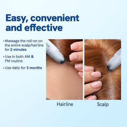 Advanced Hair Growth Roll-On Serum